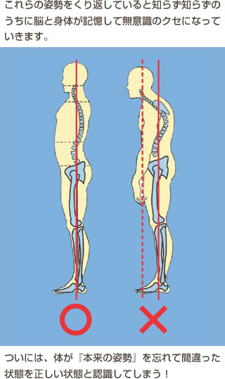 これらの姿勢をくり返していると知らず知らずのうちに脳と身体が記憶して無意識のクセになっていきます。